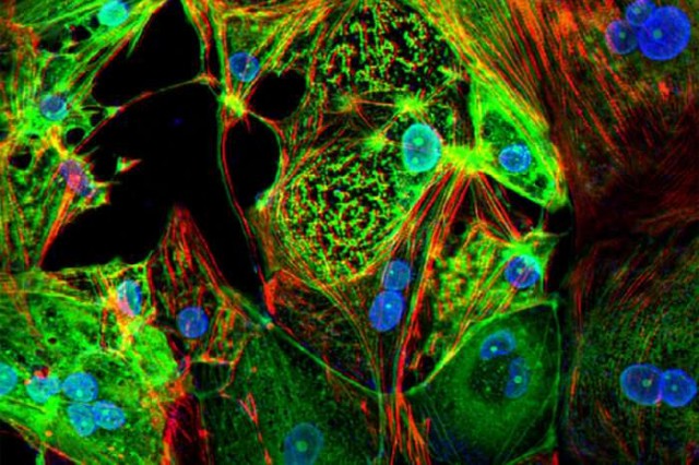 Вчені показали клітини серцевого м’яза людини (червоні) і інфіковані SARS-CoV-2 (зелений)