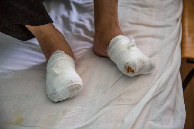 Микиті доведеться заново вчитися ходити